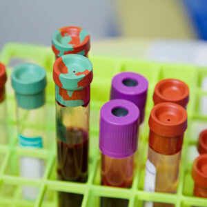 lab-work-vials
